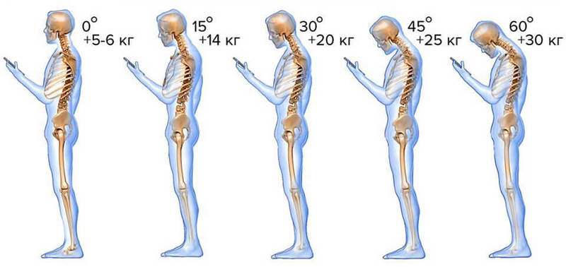Самое вредное — это сидеть! Нагрузка на позвоночник в цифрах