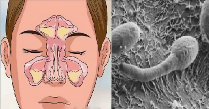 Проблема вашего заложенного носа находится в вашем кишечнике!