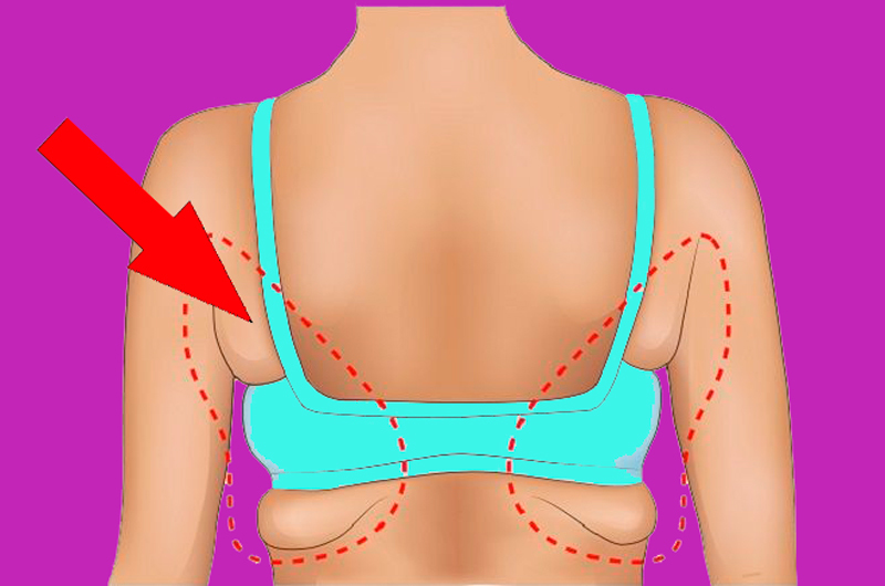 Упражнение, которое уберет жировые отложения в зоне лопаток