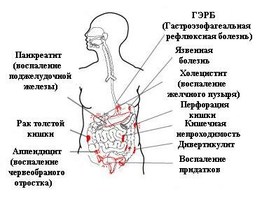 Боли в желудке — причины, лечение. Как узнать, что именно болит?