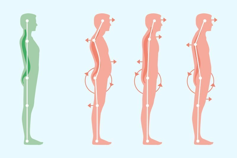 Растяжка: 4 эффективных упражнения для исправления осанки