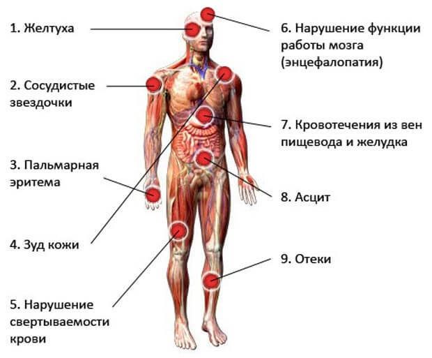 Признаки болезни печени