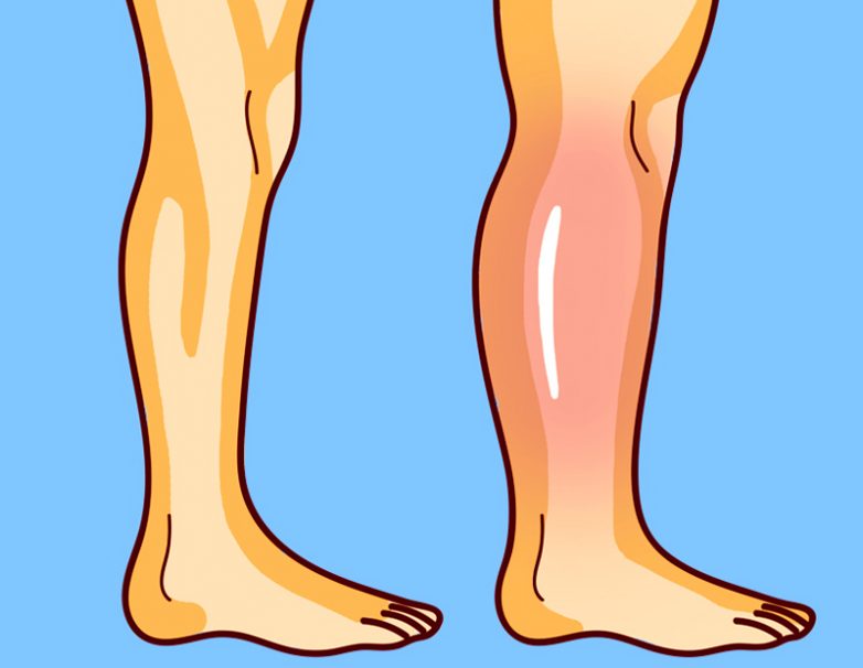 Упражнения от остеопата для снятия отёков ног