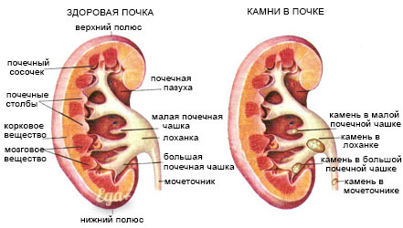 Причины цистита и урологических проблем, о которых вы могли не знать