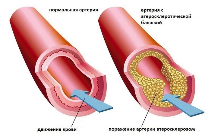 Врачи молчат об этом! Эти 8 продуктов очищают организм лучше любых лекарств.