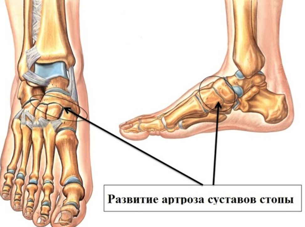 Когда косточки хрустят