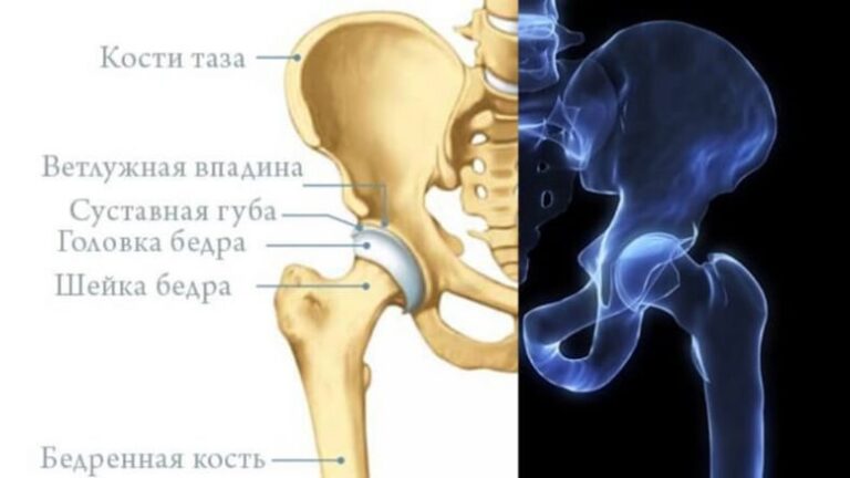 Строение Тазобедренного Сустава У Женщин Фото